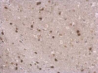 Immunohistochemistry-Paraffin: NPAS1 Antibody [NBP2-43651]