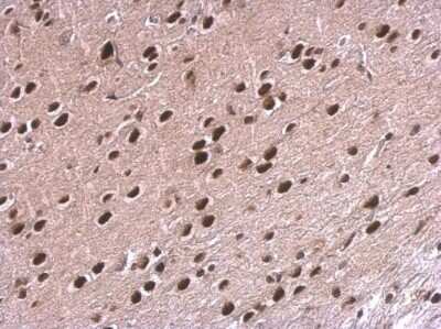 Immunohistochemistry-Paraffin: NPAS1 Antibody [NBP2-43651]