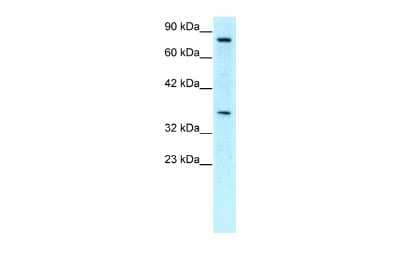 Western Blot: NPAS1 Antibody [NBP2-85395]