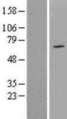 Western Blot: NPAS1 Overexpression Lysate [NBL1-13739]