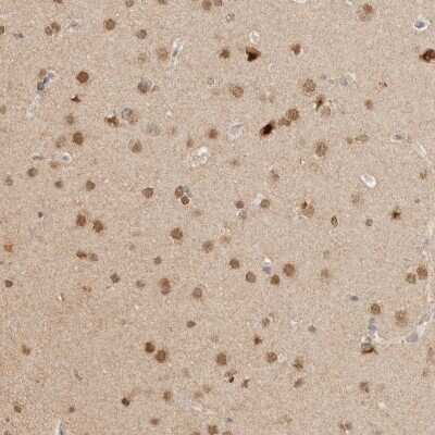 Immunohistochemistry-Paraffin: NPAS2 Antibody [NBP1-88612]