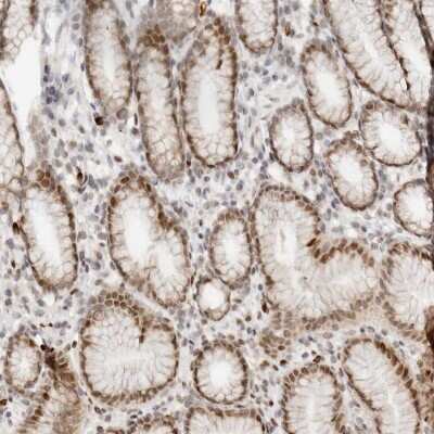 Immunohistochemistry-Paraffin: NPAS2 Antibody [NBP1-88612]