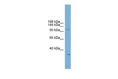 Western Blot: NPAS2 Antibody [NBP3-10407]