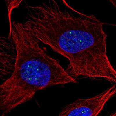 Immunocytochemistry/ Immunofluorescence: NPAT Antibody [NBP2-56922]