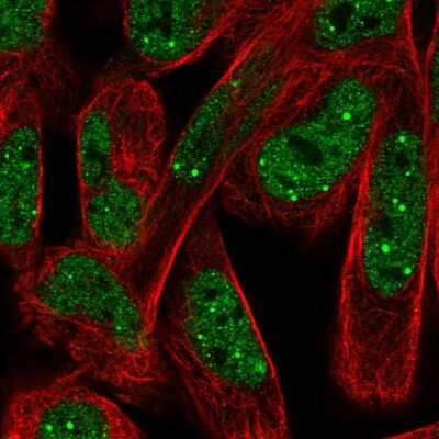 Immunocytochemistry/ Immunofluorescence: NPAT Antibody [NBP2-58659]