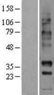 Western Blot: NPBWR1 Overexpression Lysate [NBL1-13741]