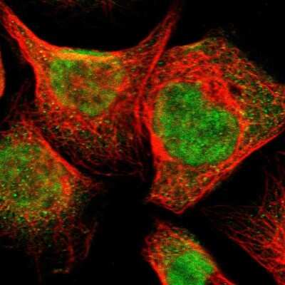 Immunocytochemistry/ Immunofluorescence: NPDC-1 Antibody [NBP1-86693]