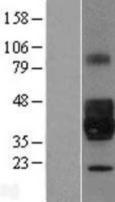 Western Blot: NPDC-1 Overexpression Lysate [NBL1-13744]