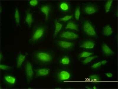 Immunocytochemistry/ Immunofluorescence: NPEPL1 Antibody (3F8-1A6) [H00079716-M01]