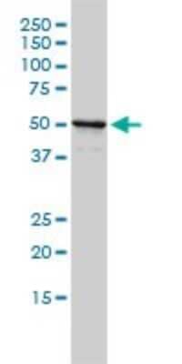 Western Blot: NPEPL1 Antibody (3F8-1A6) [H00079716-M01]