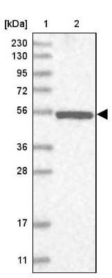 Western Blot: NPEPL1 Antibody [NBP2-13668]