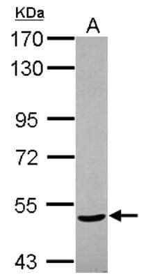 Western Blot: NPEPL1 Antibody [NBP2-19570]