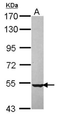 Western Blot: NPEPL1 Antibody [NBP2-19571]