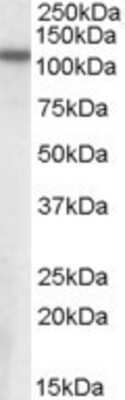 Western Blot: Puromycin-sensitive aminopeptidase/NPEPPS Antibody [NB100-93421]