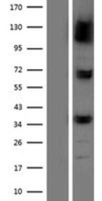 Western Blot: Puromycin-sensitive aminopeptidase/NPEPPS Overexpression Lysate [NBP2-07640]