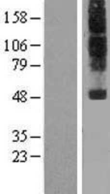 Western Blot: Neuropeptide FF R1/NPFFR1 Overexpression Lysate [NBP2-06462]