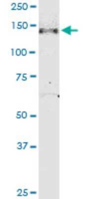 Western Blot: NPHP3 Antibody (3B1) [H00027031-M05]