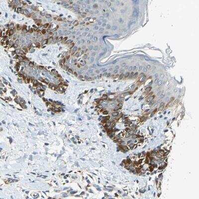 Immunohistochemistry-Paraffin: NPHP3 Antibody [NBP1-83543]