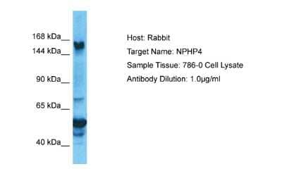 Western Blot: NPHP4 Antibody [NBP2-87938]