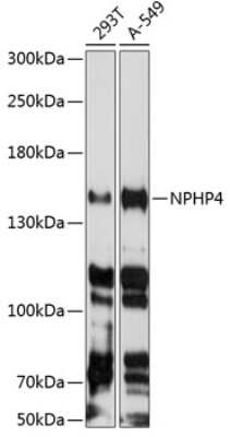 Western Blot: NPHP4 AntibodyAzide and BSA Free [NBP2-93637]