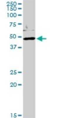 Western Blot: Podocin/NPHS2 Antibody [H00007827-D01P]