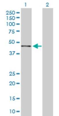 Western Blot: Podocin/NPHS2 Antibody [H00007827-D01P]