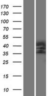 Western Blot: Podocin/NPHS2 Overexpression Lysate [NBP2-07304]