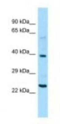 Western Blot: NPIP Antibody [NBP1-98540]