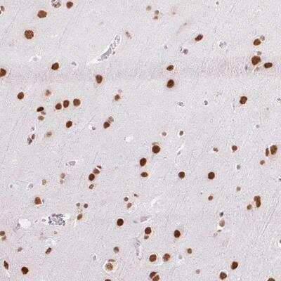 Immunohistochemistry: NPIP Antibody [NBP2-46813]