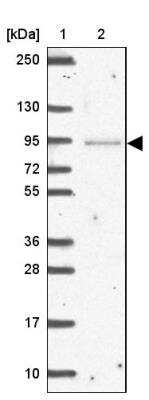 Western Blot: NPIP Antibody [NBP2-46813]