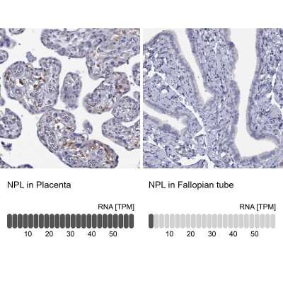 Immunohistochemistry-Paraffin: NPL Antibody [NBP3-17138]
