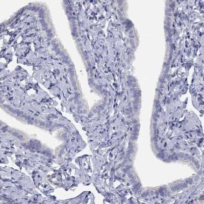 Immunohistochemistry-Paraffin: NPL Antibody [NBP3-17138]