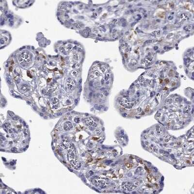 Immunohistochemistry-Paraffin: NPL Antibody [NBP3-17138]