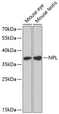 Western Blot: NPL AntibodyAzide and BSA Free [NBP2-93112]