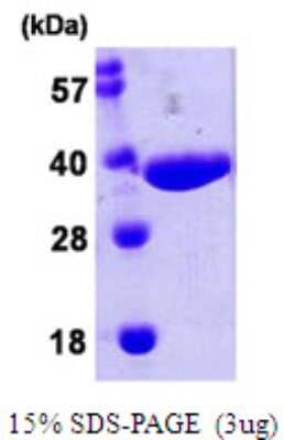 SDS-PAGE: Recombinant E. coli NPL His Protein [NBP2-22652]