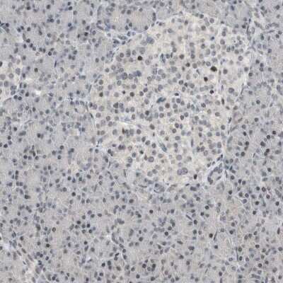 Immunohistochemistry-Paraffin: NPLOC4 Antibody [NBP1-82165]