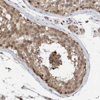 Immunohistochemistry-Paraffin: NPLOC4 Antibody [NBP1-82165]