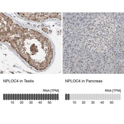 Immunohistochemistry-Paraffin: NPLOC4 Antibody [NBP1-82165]