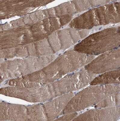 Immunohistochemistry-Paraffin: NPLOC4 Antibody [NBP1-82166]