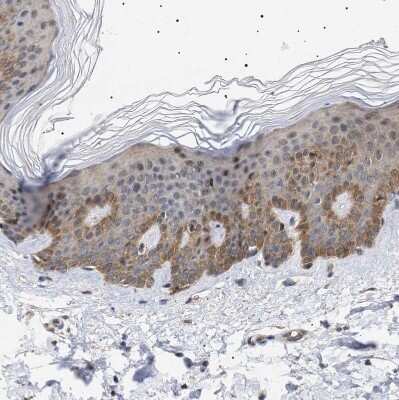 Immunohistochemistry-Paraffin: NPLOC4 Antibody [NBP1-82166]