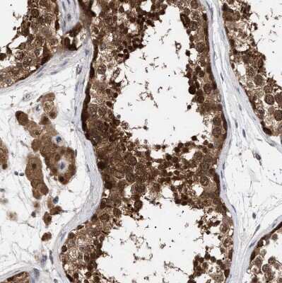 Immunohistochemistry-Paraffin: NPLOC4 Antibody [NBP1-82166]