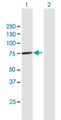 Western Blot: NPLOC4 Antibody [H00055666-B01P]
