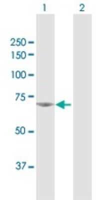 Western Blot: NPLOC4 Antibody [H00055666-D01P]