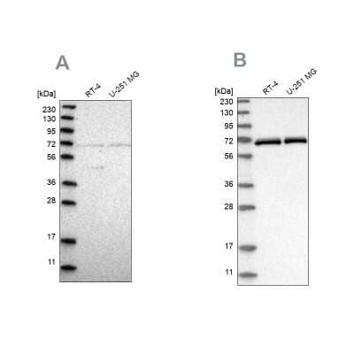 Western Blot: NPLOC4 Antibody [NBP1-82165]