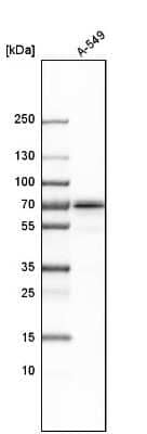 Western Blot: NPLOC4 Antibody [NBP1-82166]