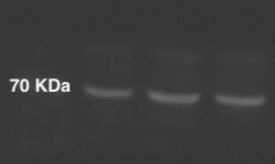 Western Blot: NPLOC4 Antibody [NBP1-82166]