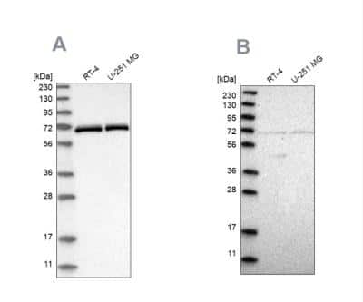 Western Blot: NPLOC4 Antibody [NBP1-82166]