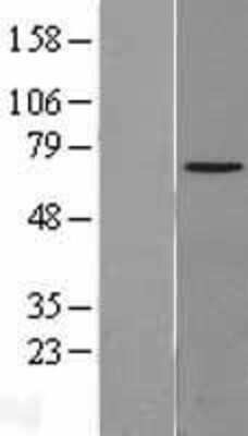 Western Blot: NPLOC4 Overexpression Lysate [NBL1-13747]