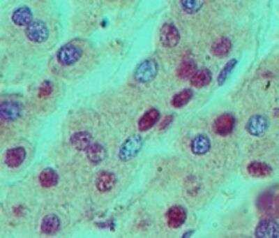 Immunohistochemistry-Paraffin: NPM1 Antibody [NBP2-27157]