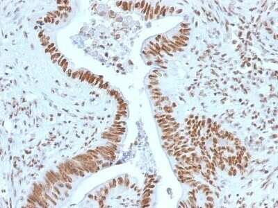 Immunohistochemistry-Paraffin: NPM1 Antibody (NPM1/1902) - Azide and BSA Free [NBP2-79874]
